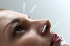 Acupuncture can help reduce allergies