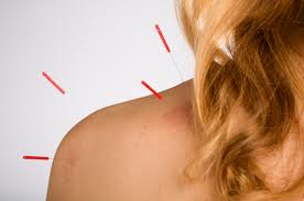Acupuncture can help treat many physical and emotional conditions.